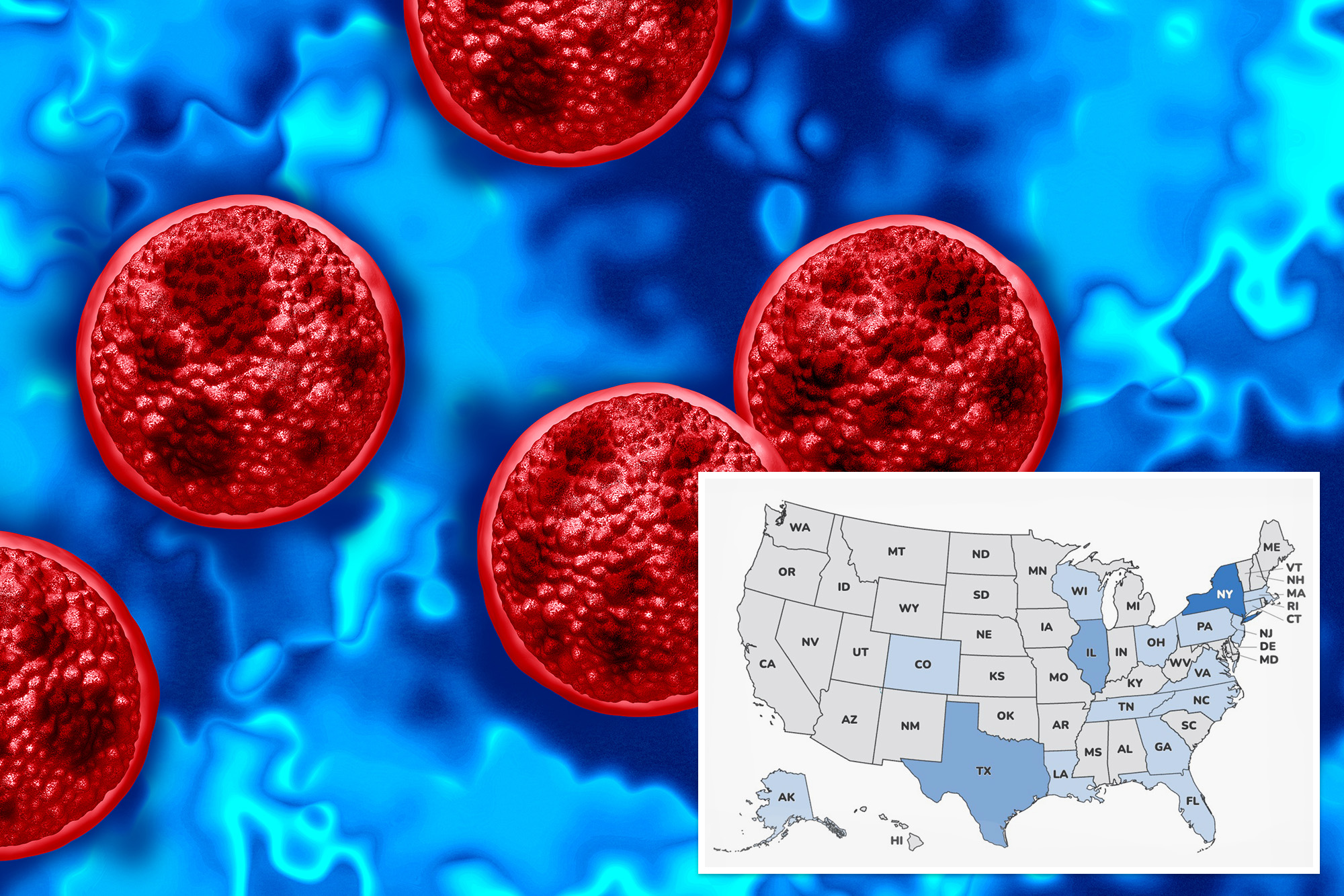 Explosive diarrhea parasite invades Long Island as separate bacteria ...