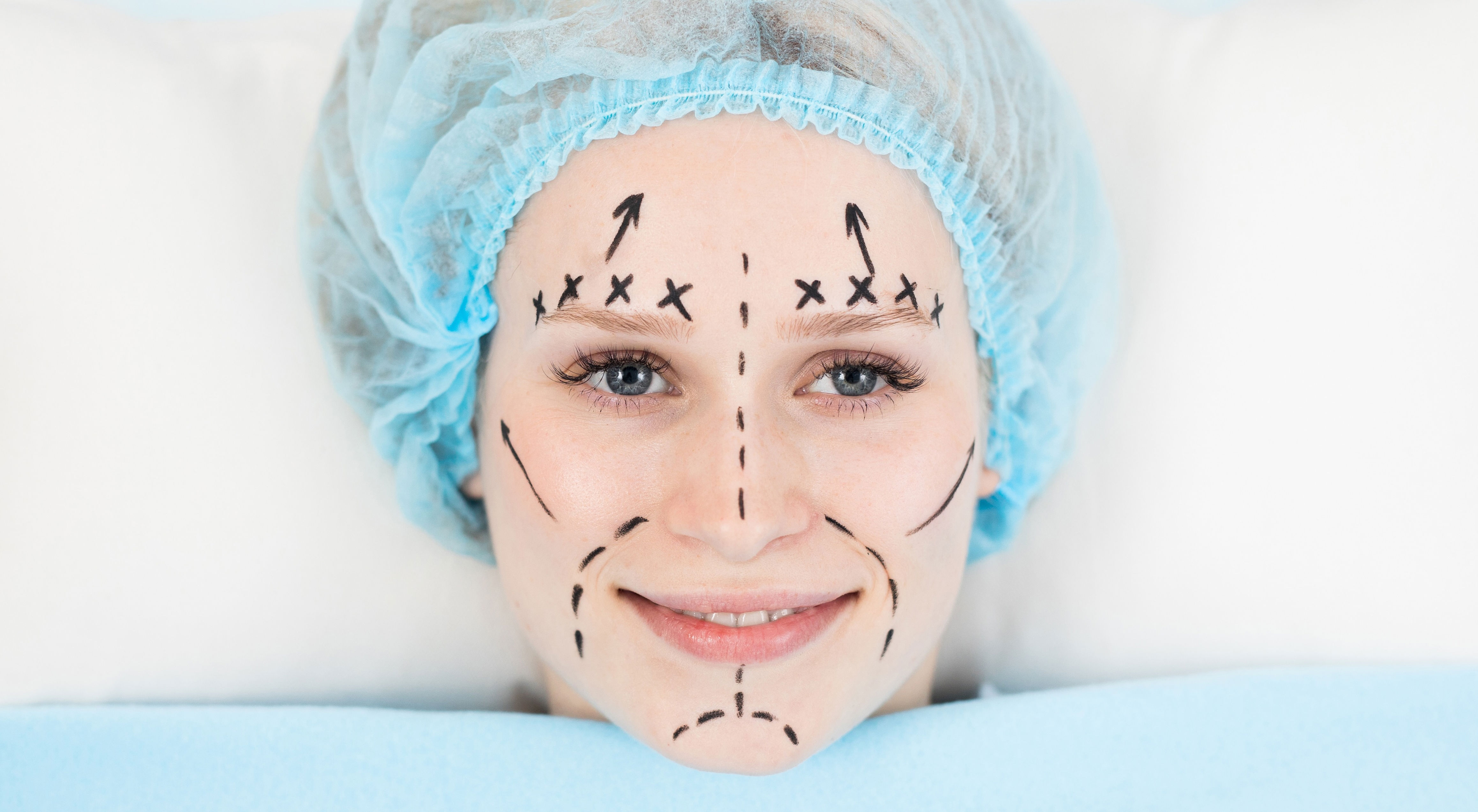 ‘Fillers can only do so much.’ How ‘Ozempic face' is pushing more Gen Xers toward cosmetic surgery — and they're already the biggest users of Botox