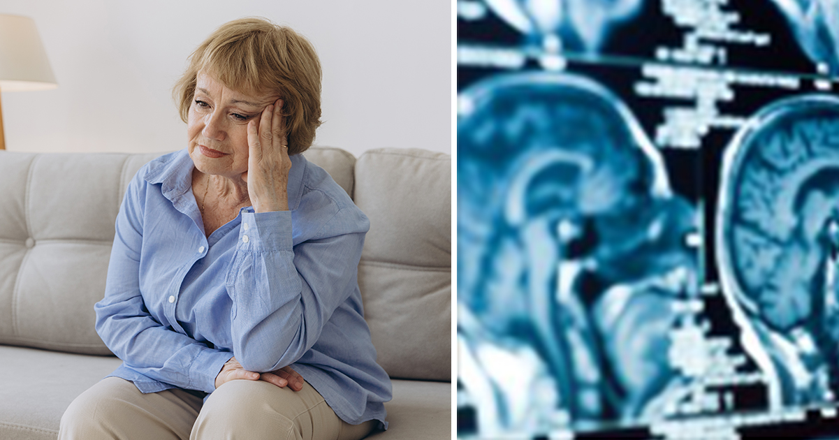 New study reveals hidden dementia sign that can appear 15 years before diagnosis