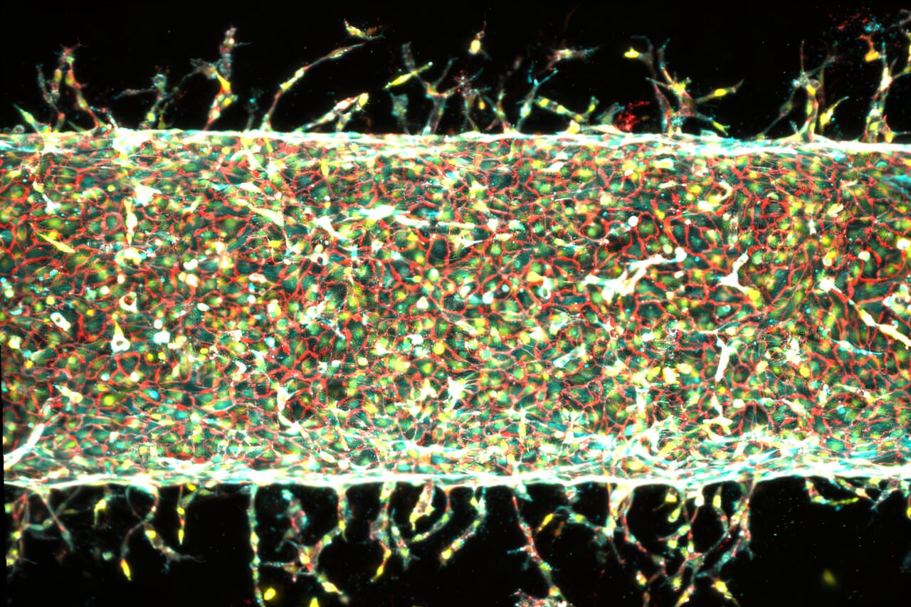Engineers find a precise way to grow artificial blood vessels
