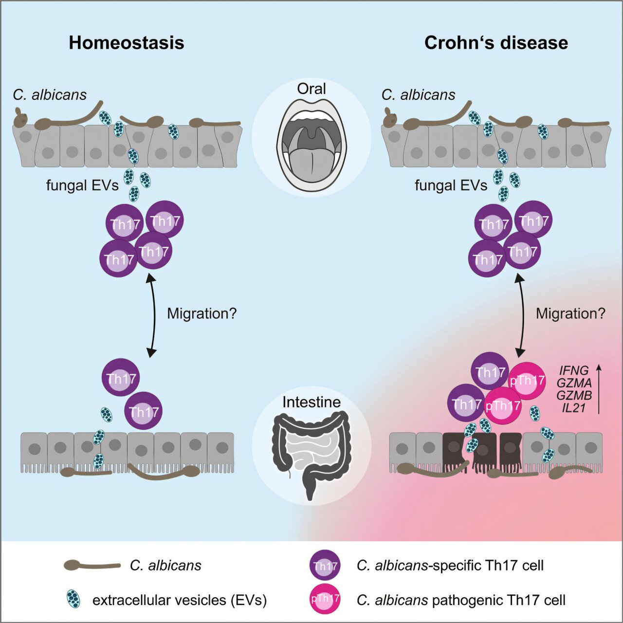 Immune response to otherwise harmless yeast becomes a problem in Crohn's disease