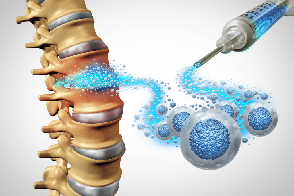 Scientists Take Major Step Toward Stem Cell Treatment for Paralysis
