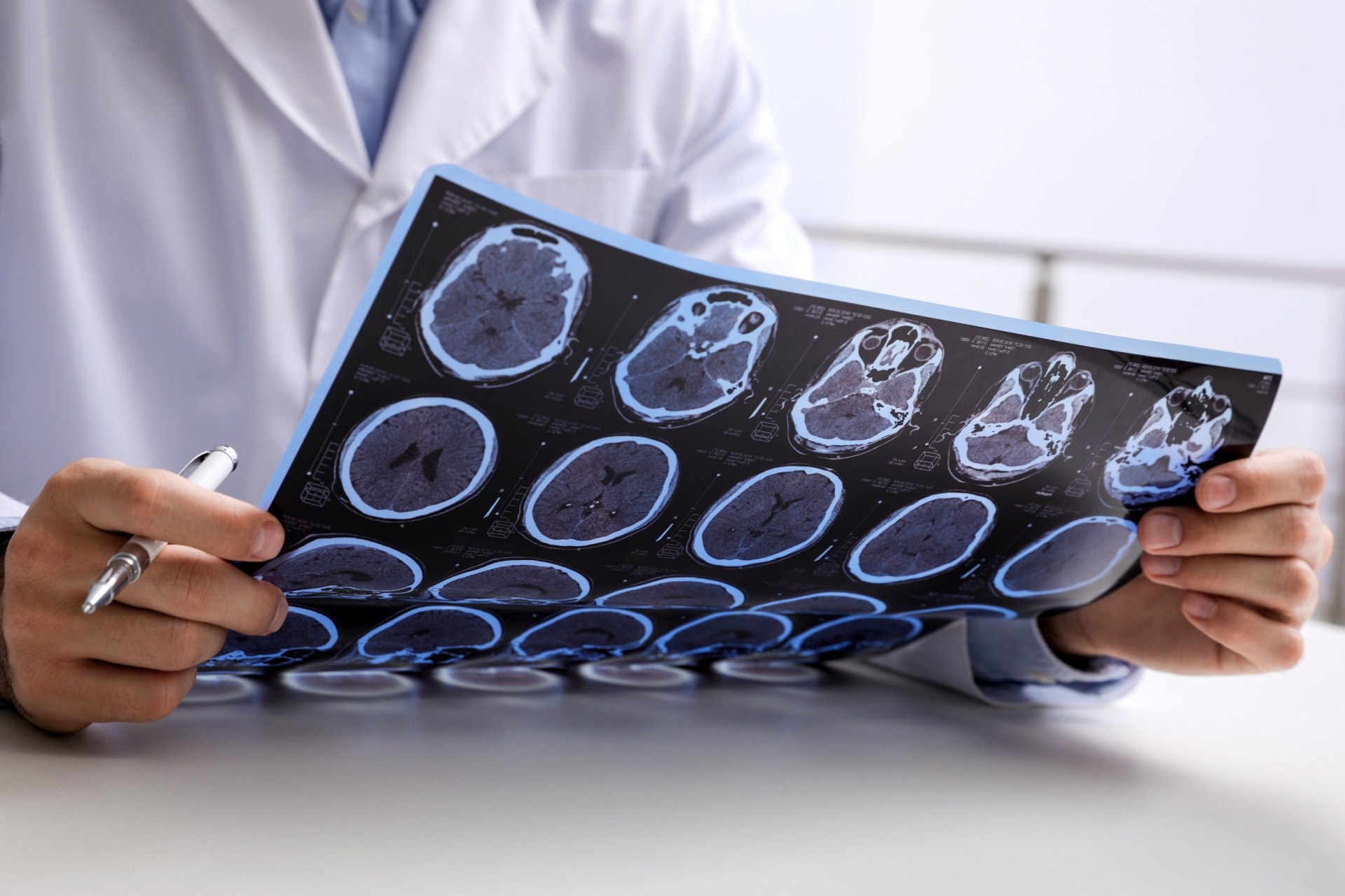 Doctor examining MRI images of patient