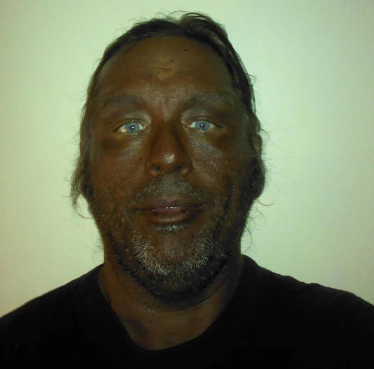 melanotan peptide reddit ed Should You Try Stacking? This guy injected himself with