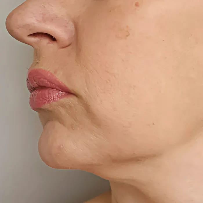 The Face-Lifting Exercises That Can Help Tighten Sagging Skin Naturally: Duck Lips Exercise, More