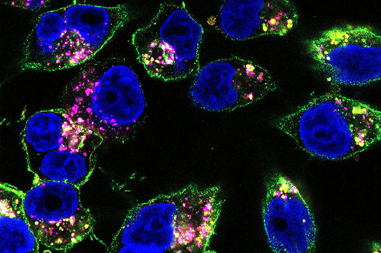 Shape-shifting drug hits tumors in multiple ways, improves outcomes in mice