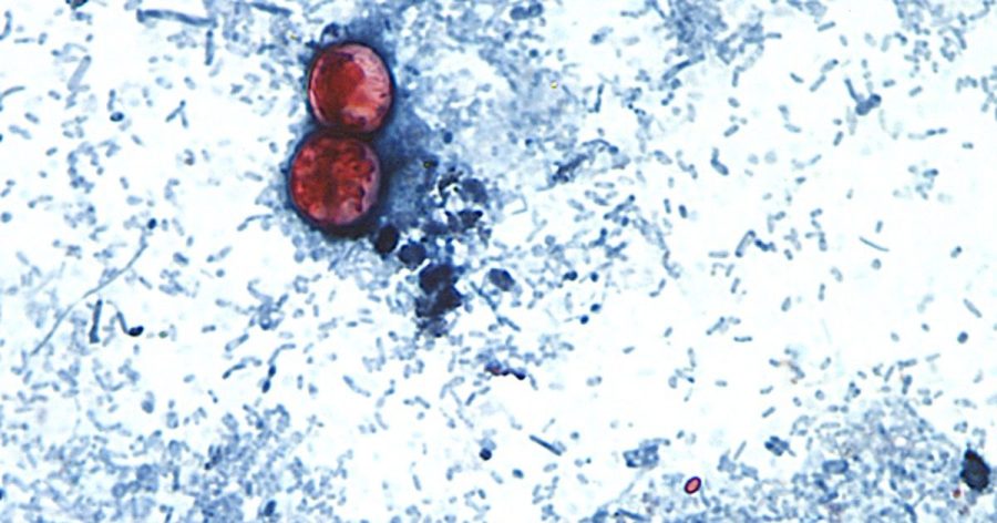 Ohio cyclospora cases climb as investigation continues