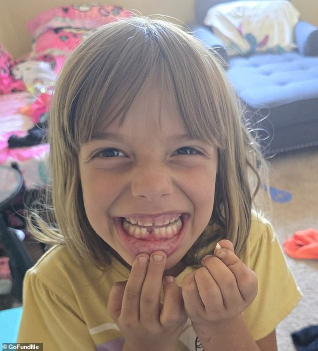 The little girl underwent surgery at UC Davis after the dog attack. Patricia's grandmother said she was in critical condition after the pack of dogs attacked her
