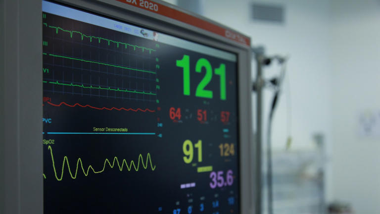 Both a very low and a very high resting heart rate may raise stroke risk