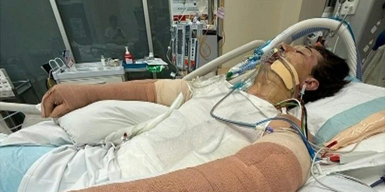 Ein Patient mit Kopfverband und verbundenen Armen liegt beatmet auf einem Krankenbett im Krankenhaus.