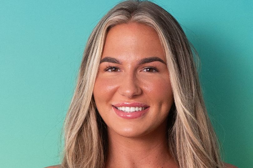 Love Island beauty's rare genetic trait she shares with Megan Fox and just 1% of Brits