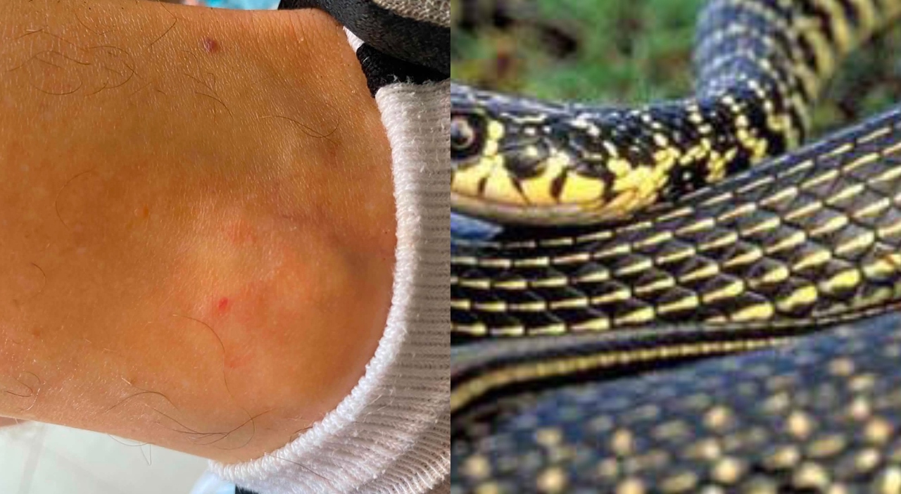 Passeggia per Roma e viene morso da un serpente: «Stavo saltando, mi ha ...