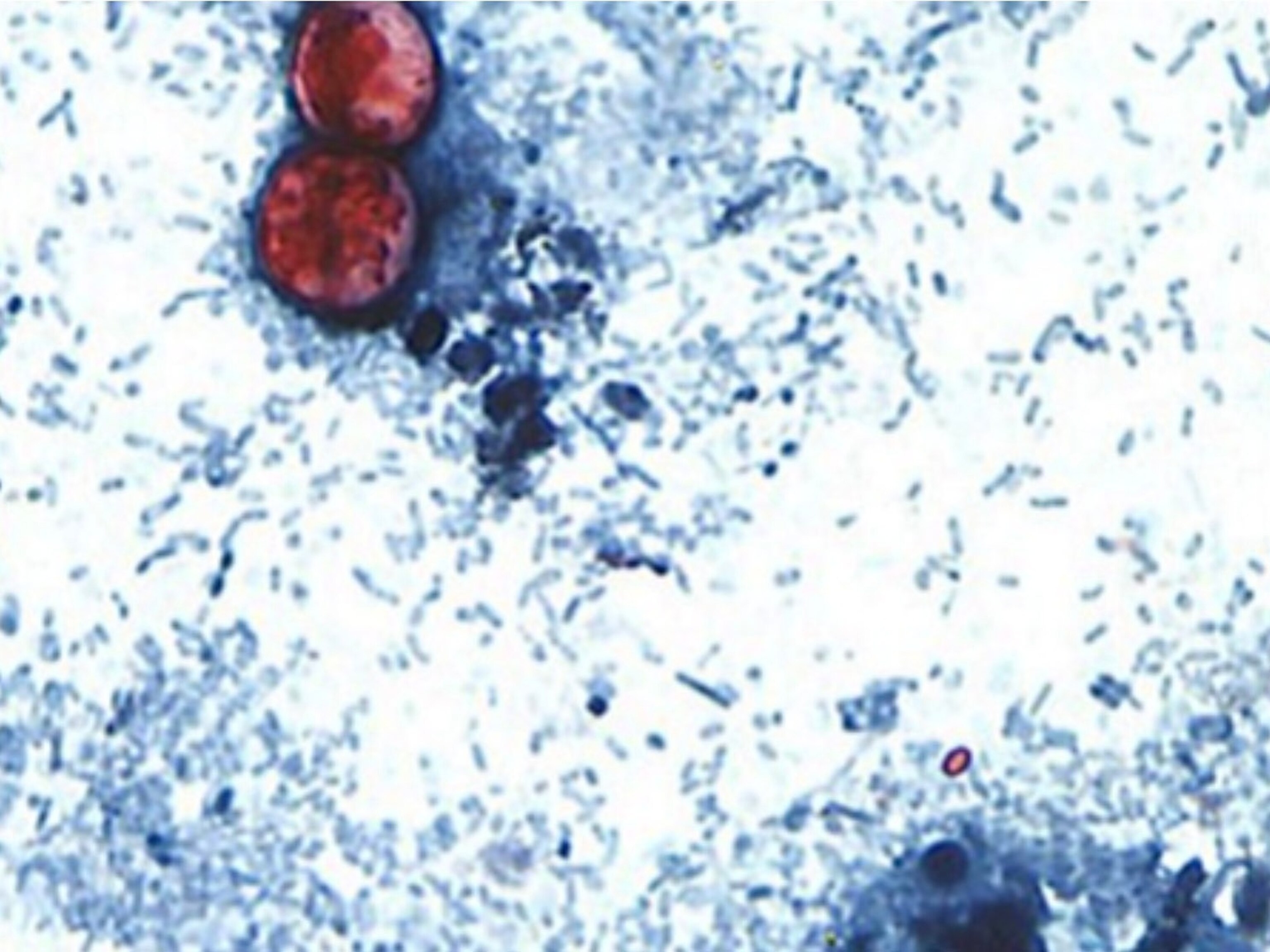 Cyclosporiasis cases near 1,000 in Michigan, health officials say