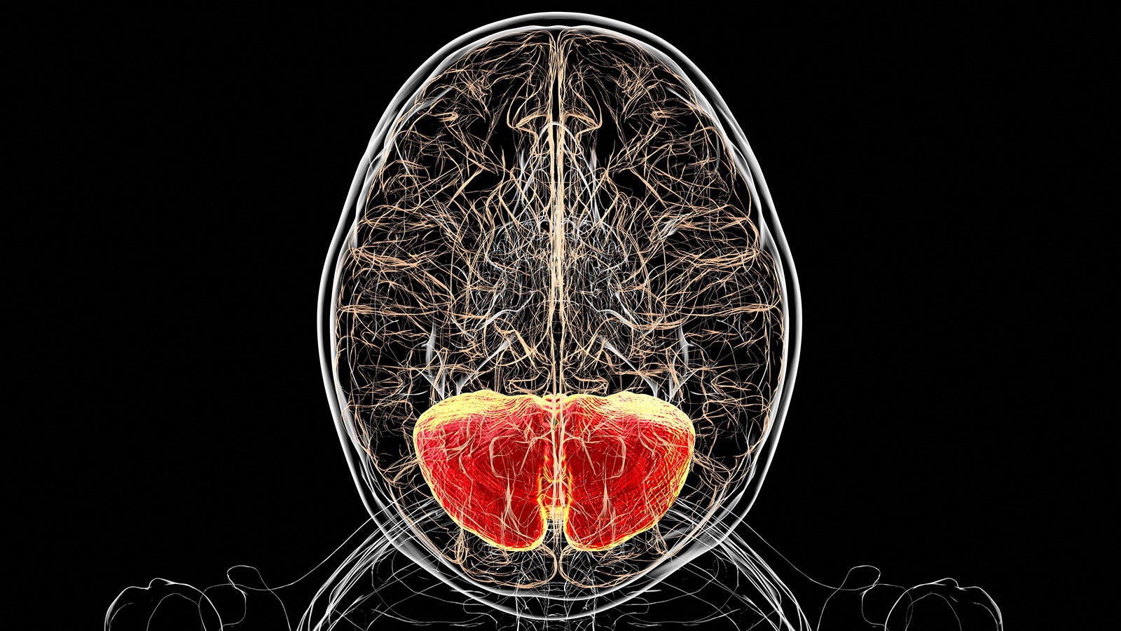 Modified amino acid improves neurologic symptoms in rare genetic disorder