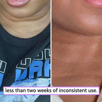 Before and after comparison of a skincare product on neck area, showing noticeable improvement in skin texture and smoothness