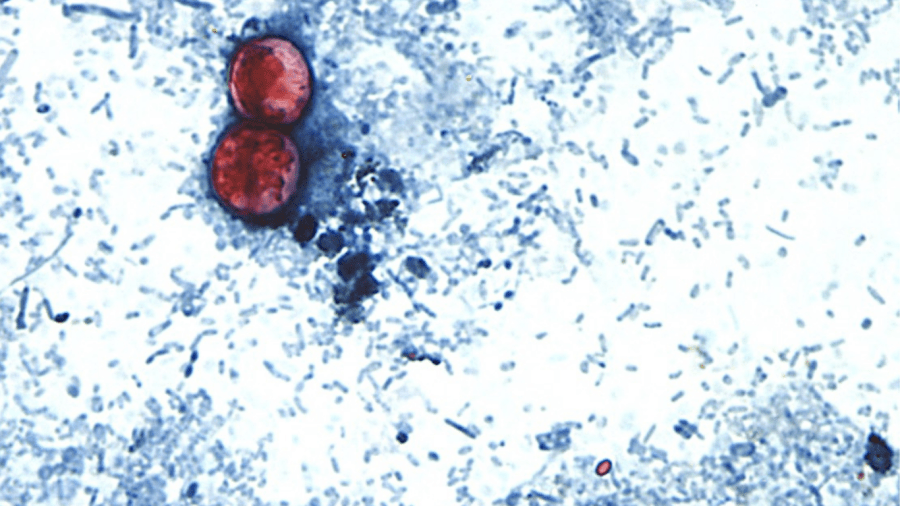 How could cyclospora get into the food supply?