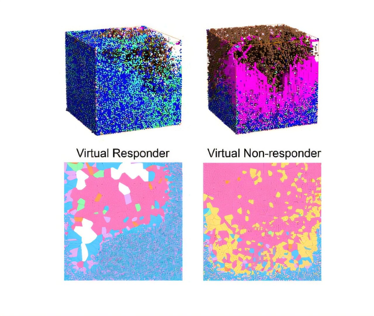 Virtual tumor predicts response to liver cancer immunotherapy