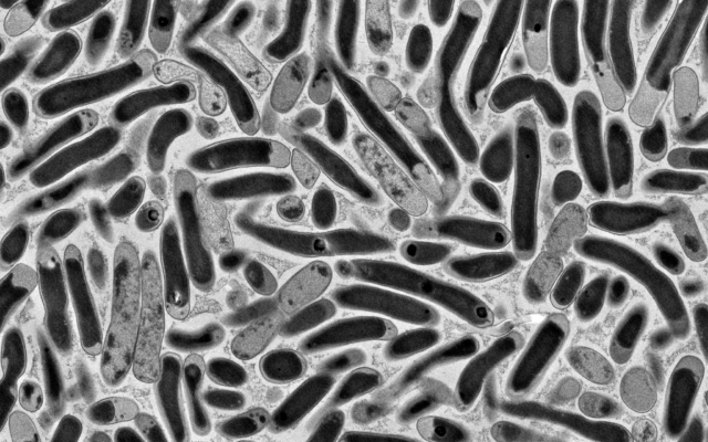 Genetically engineered E. coli bacteria from the Ron Milo Laboratory at the Weizmann Institute of Science, Rehovot, central lsrael. (Courtesy)