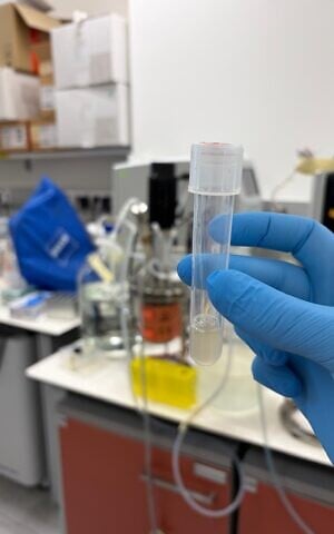 E. coli that have undergone genetic manipulation at the Ron Milo Laboratory, Weizmann Institute, Rehovot, Central Israel. (Courtesy)