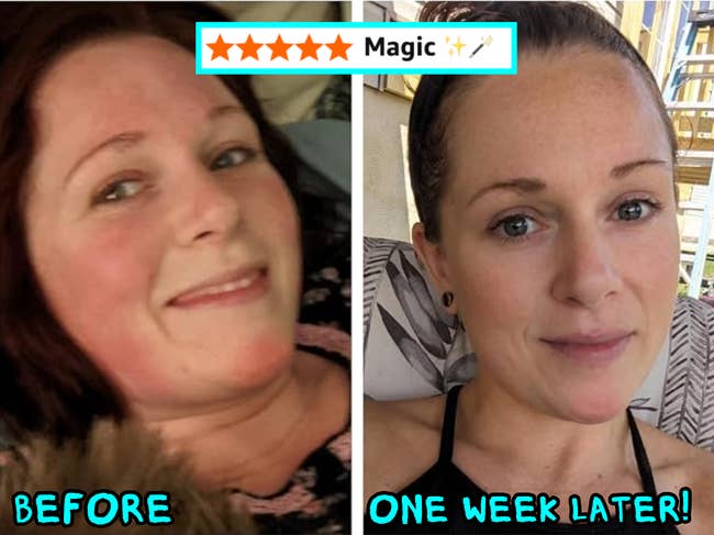Side-by-side photos of a woman smiling. Left: labeled