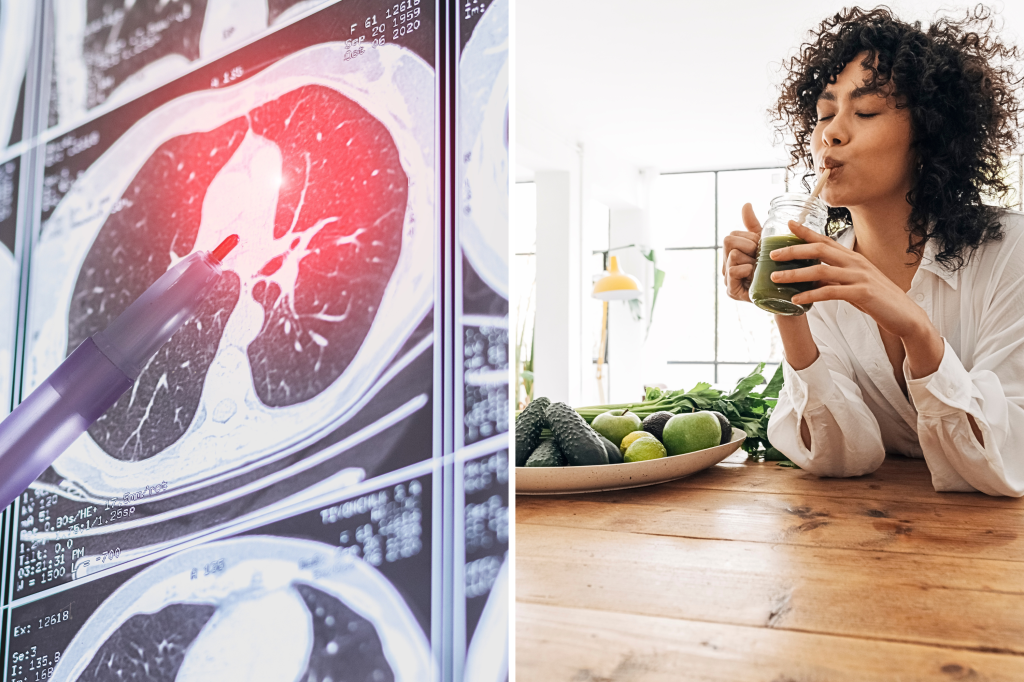 Non-smokers under 50 are getting lung cancer. What they eat raised a red flag