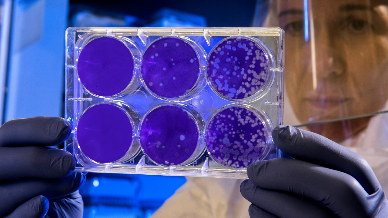 Scientists found a hidden antibiotic 100 times stronger than today’s drugs against superbugs
