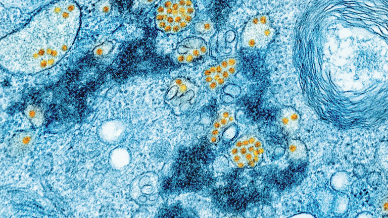 A drug-resistant fungus called Candida auris is spreading through ...