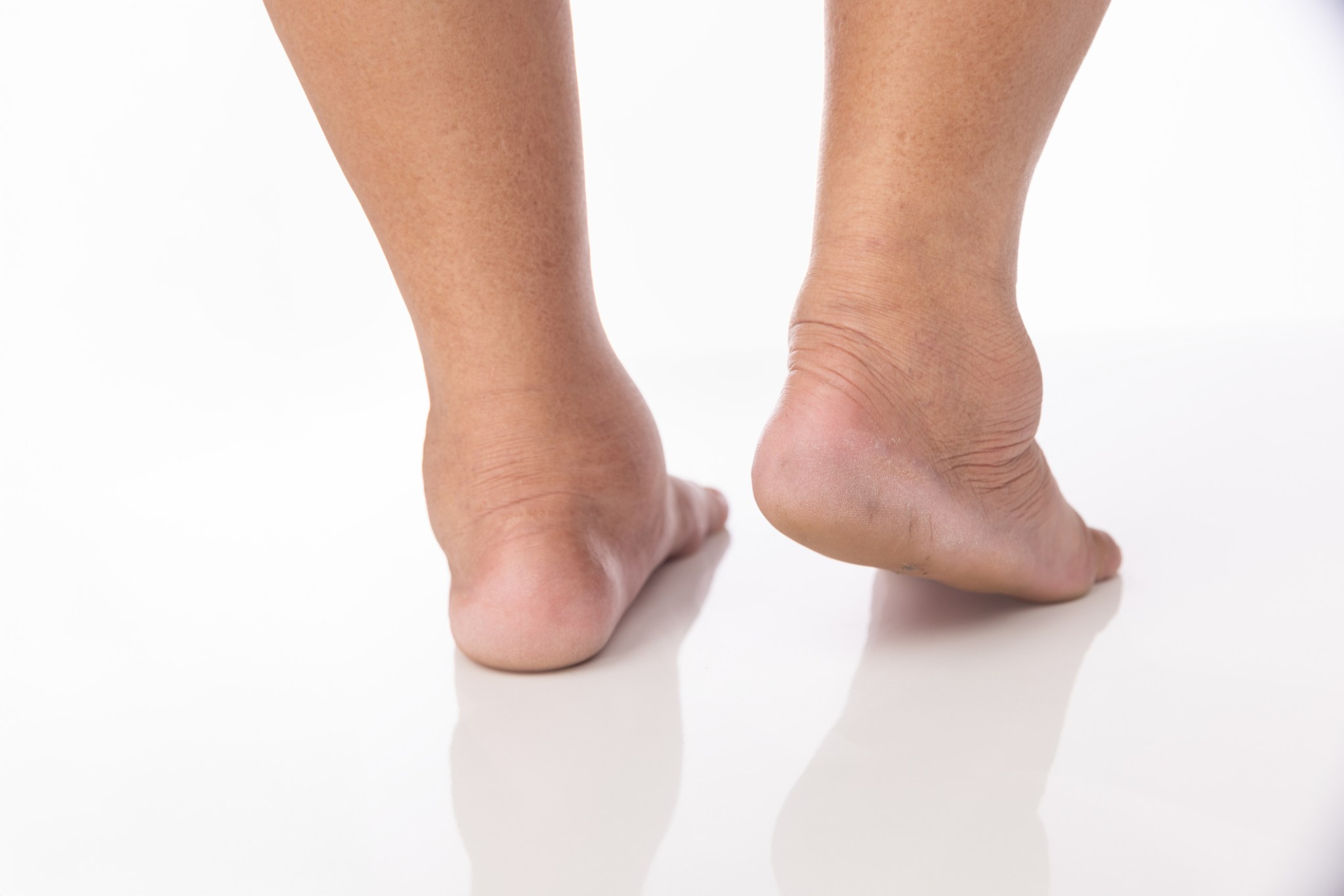 Feet