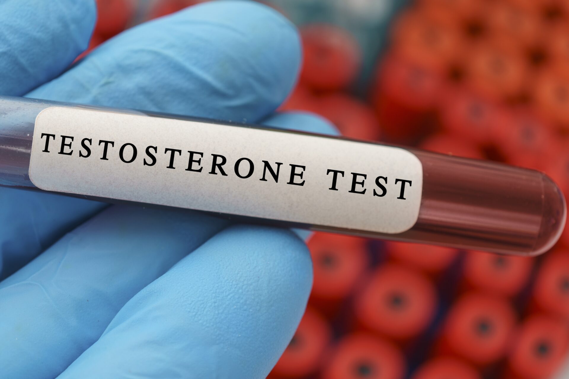 Men artificially boost testosterone in pursuit of the ultimate masculinity