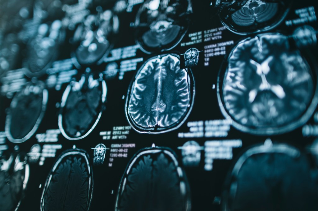Scientists discover hidden brain structure that could help fight Alzheimer’s