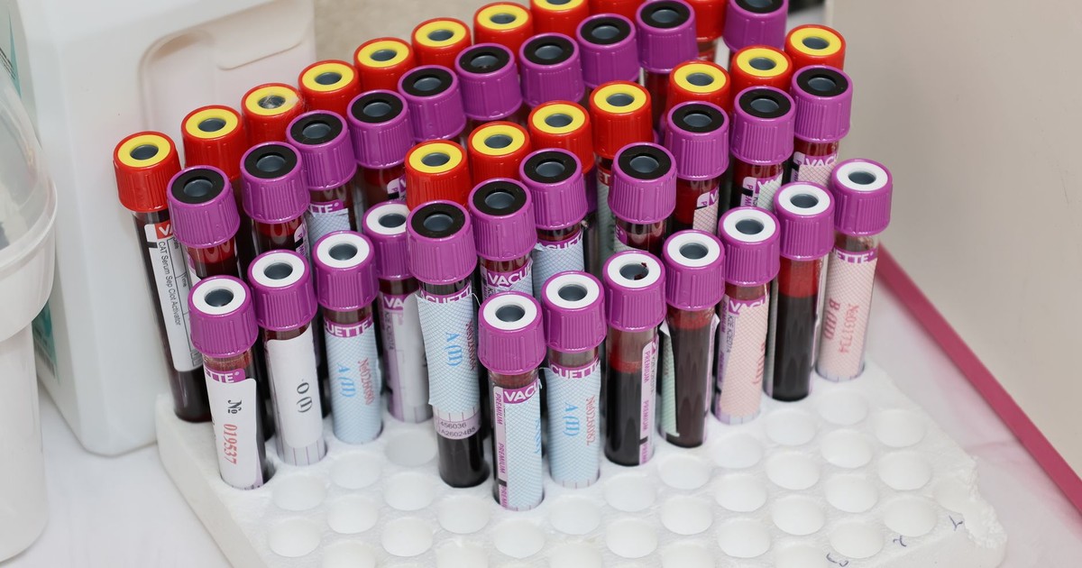Study Shows a Blood Test Can Help Identify Healthy People at High Risk for Alzheimer's Disease