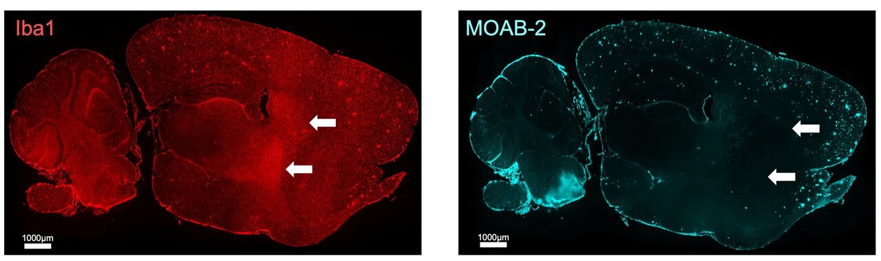Two hours of sleep restored: Researchers make Alzheimer's breakthrough