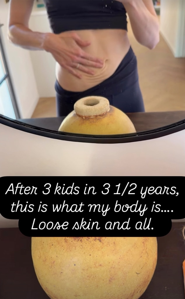 Mandy Moore Shares Candid Look at Postpartum Body