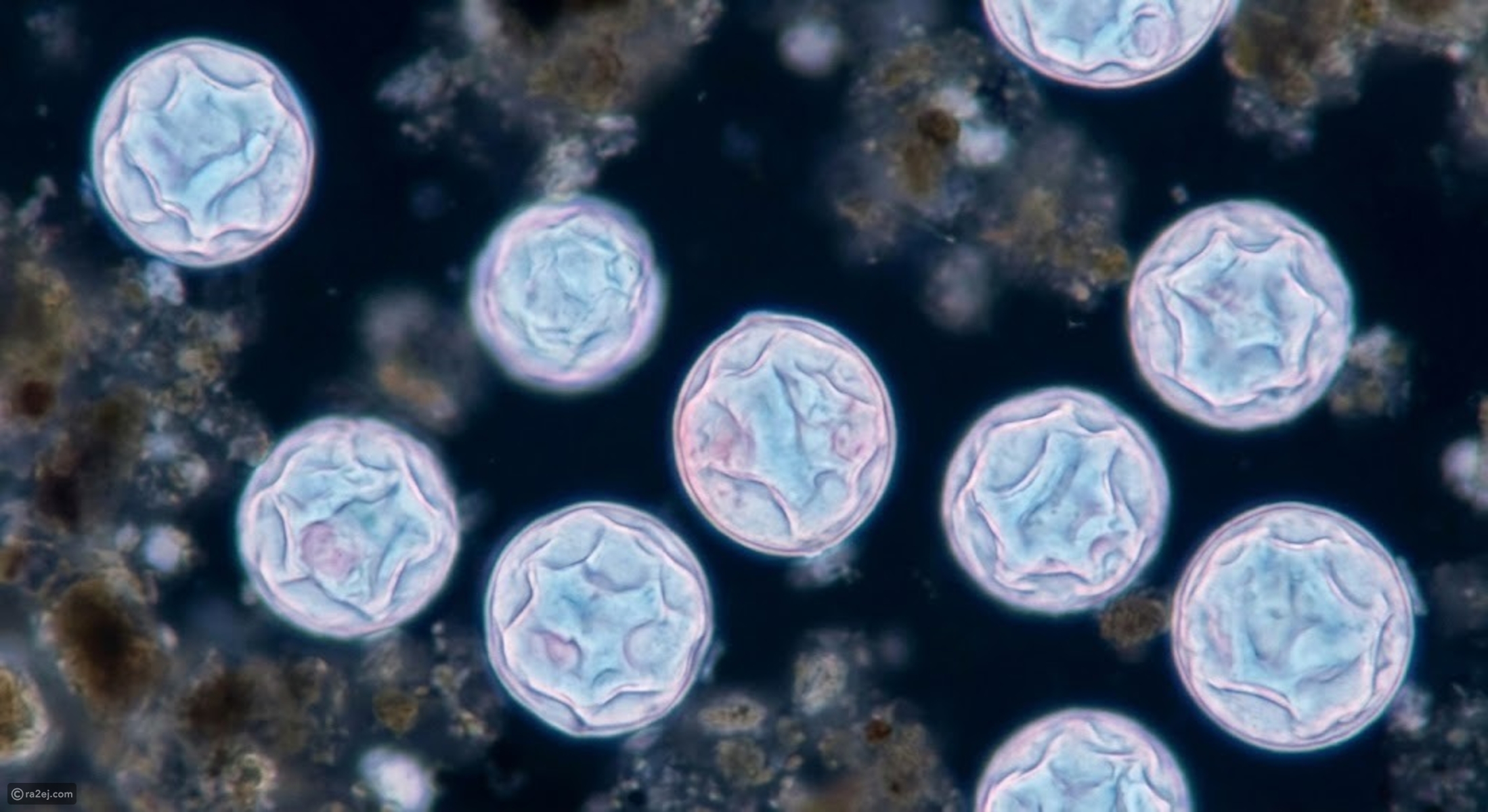 Explosive diarrhea outbreak — symptoms, causes and treatments explained