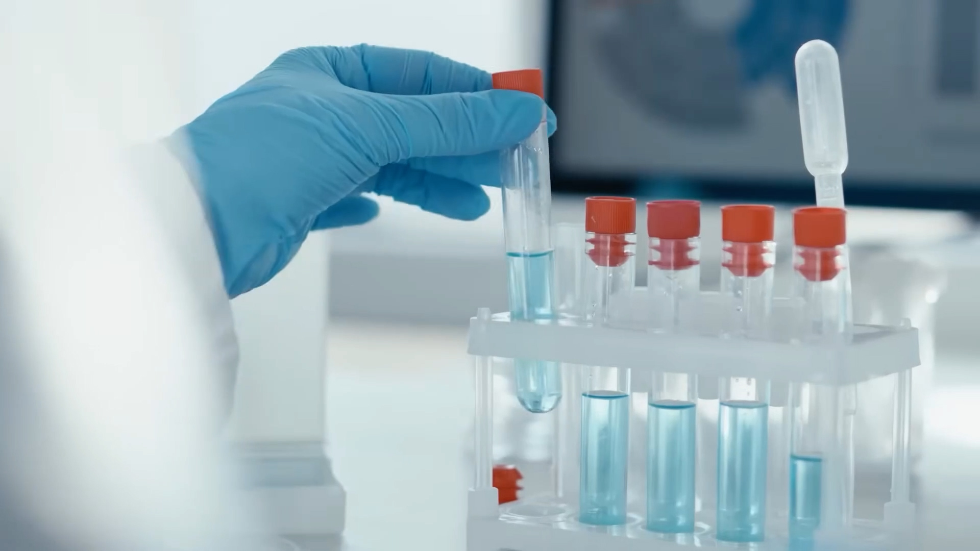 The deadliest infectious diseases ever, ranked by sheer body count