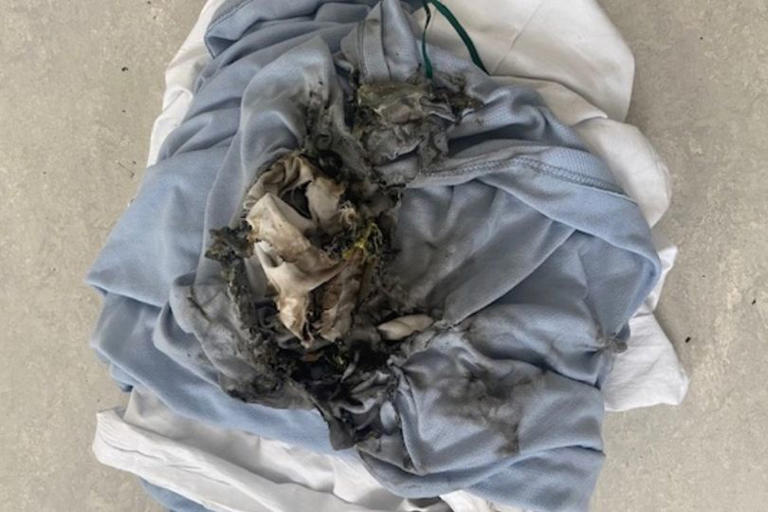 The blanket damaged by the fire at Sunderland Royal Hospital