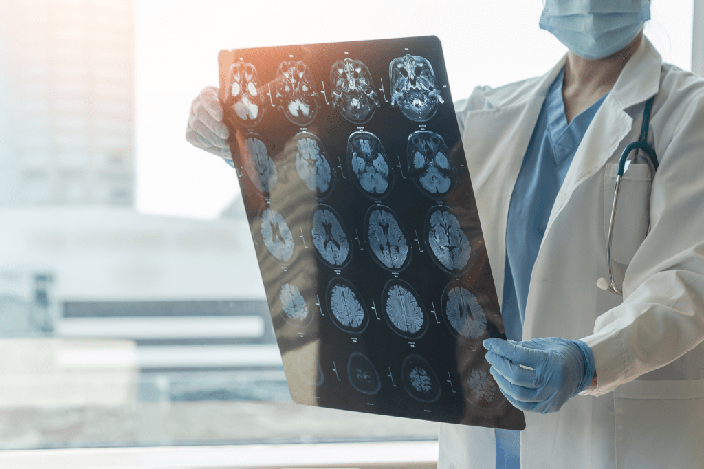 Scientists find drug that may fight Alzheimer’s on multiple fronts