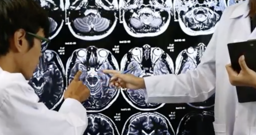 Scientists Reveal a New Discovery About the Brain’s Final Moments Before Death