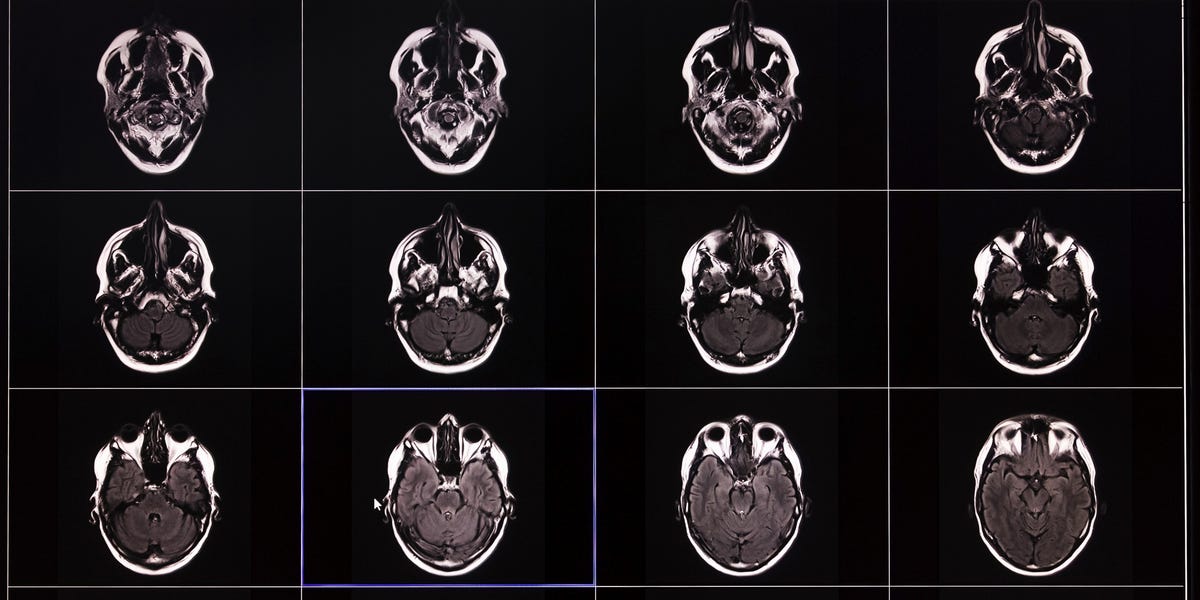 What Scientists Discovered After 10,00 Brain Scans