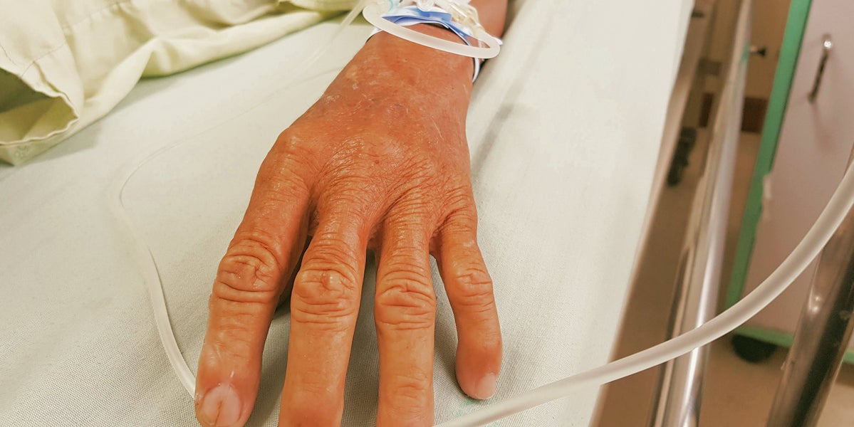 People who've been in comas revealed what it was really like
