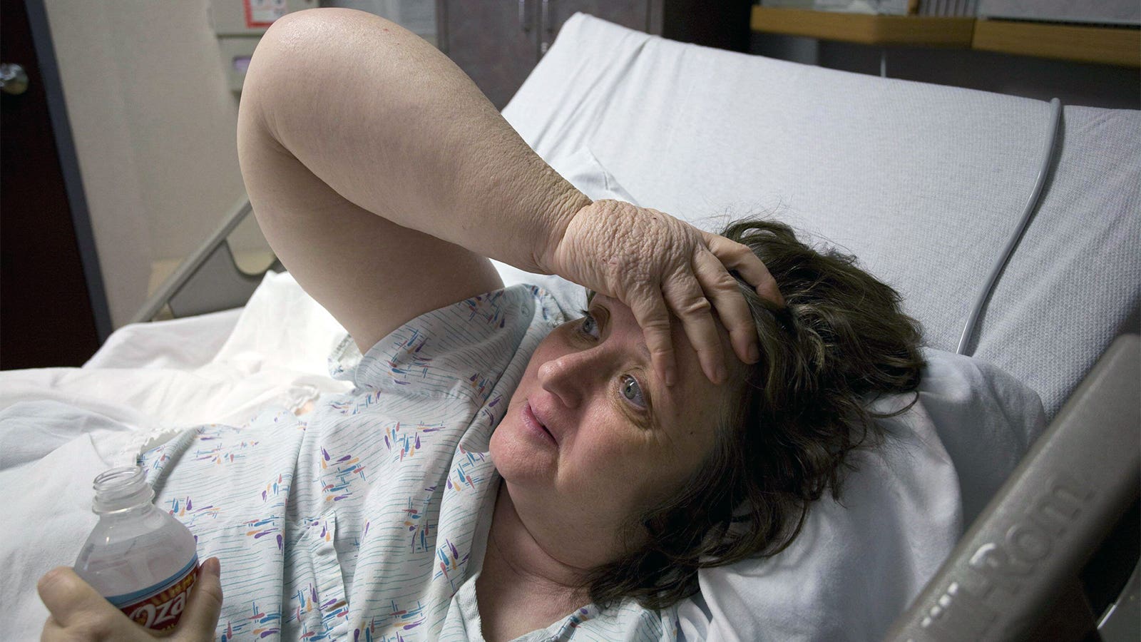 Lymphedema in breast cancer: Longer radiation course not better