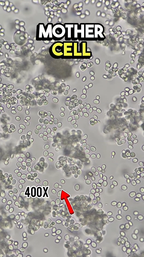 What yeast really looks like under a microscope