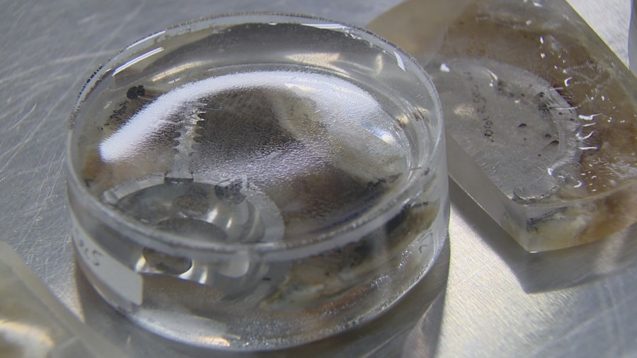 Rush researchers investigate why artificial joints fail prematurely