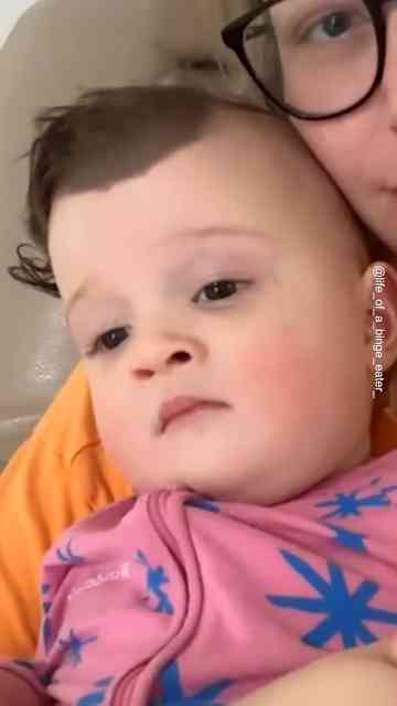 They told me to remove my baby's birthmark 💔 #RareBirthmark # ...