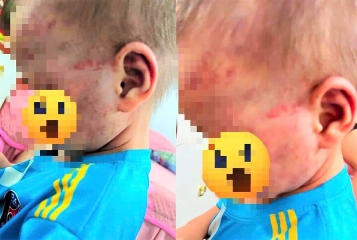 Lời khai của cha dượng vụ đánh con riêng 3 tuổi của vợ, khiến bé phải nhập viện