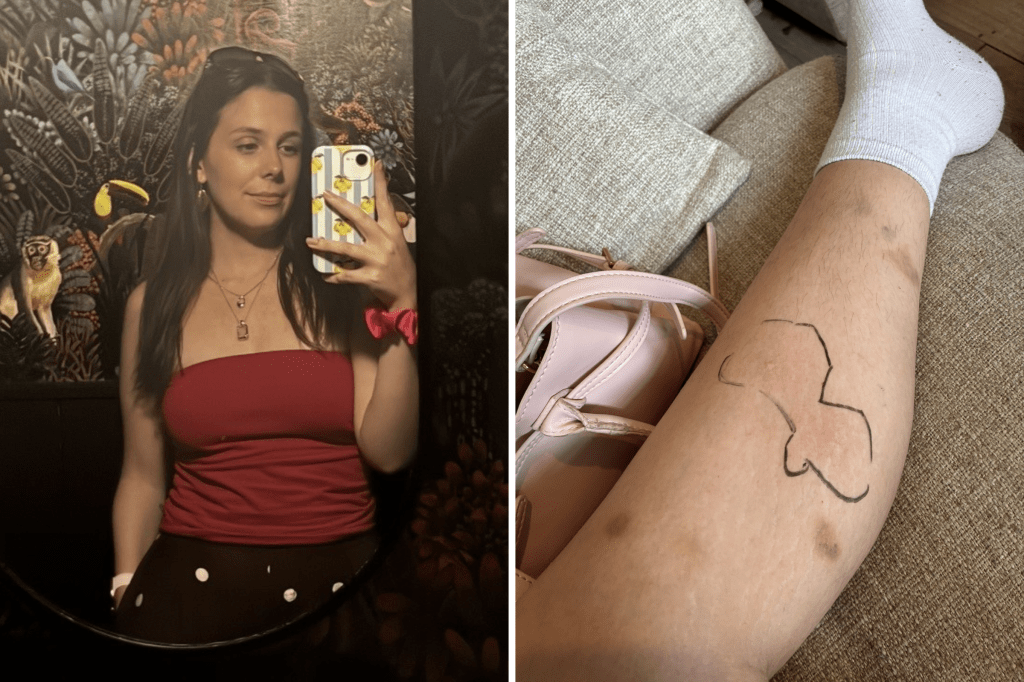 Woman ignored her “normal” symptoms for years, then everything changed