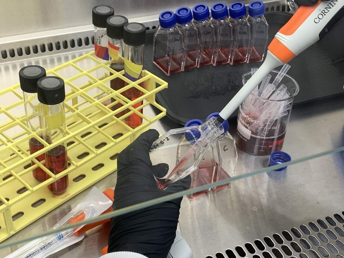Lutackas changes the media for the threatened baby mussels she raises in the lab.