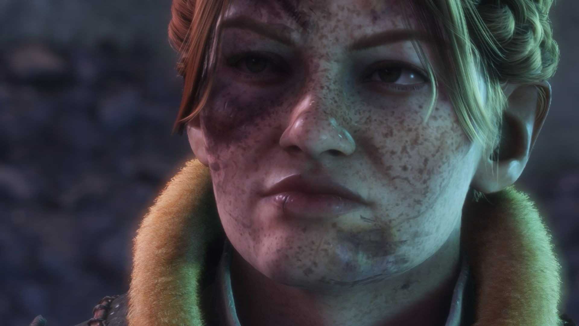 Lace Harding injured in Dragon Age The Veilguard