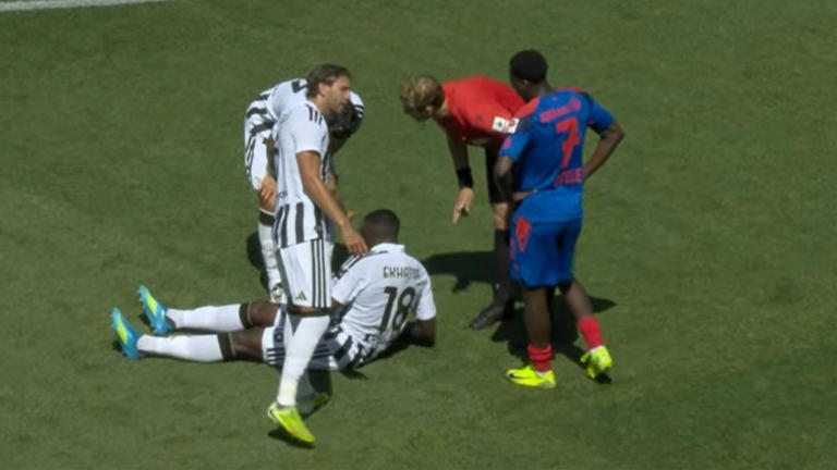 Infortunio Ekhator in Basilea-Juventus: gli esami, le condizioni del ...
