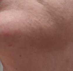 Close-up of skin texture, highlighting natural pores and minor blemishes